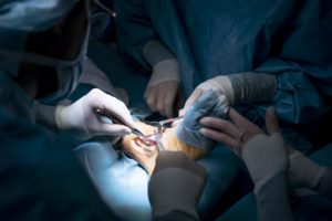 Doctors sewing a wound from an ankle operation in hospital